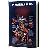 Diarrhea Causes: Learn about the various causes of diarrhea, a common digestive issue characterized by loose and frequent bowel movements. Diarrhea Causes: Learn about the various causes of diarrhea, a common digestive issue characterized by loose and frequent bowel movements. Paperback