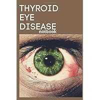 THYROID EYE DISEASE: Journal 100 Pages 6x9 Soft Cover, Matte Finish