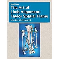 The Art of Limb Alignment: Taylor Spatial Frame The Art of Limb Alignment: Taylor Spatial Frame Paperback Kindle