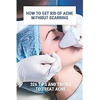 How To Get Rid Of Acne Without Scarring: 326 Tips And Tricks To Treat Acne: Natural Pimples Cure