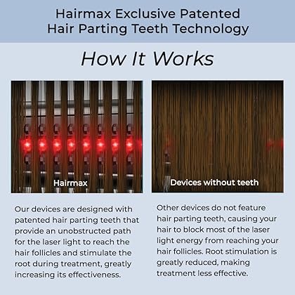 HairMax Ultima 9 Classic LaserComb (FDA Cleared) Hair Growth Device. Stimulates Hair Growth, Reverses Thinning, Regrows Denser, Fuller Hair. Targeted Hair Loss Treatment.