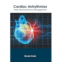Cardiac Arrhythmias: From Mechanisms to Management