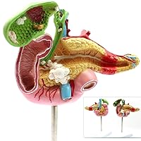 Teaching Model,Pathological Model of Pancreas, Medical Pathological Model of Pancreas, Duodenum and Gallbladder, Liver and Intestines are Suitable for School Medical Teac