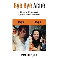 Bye Bye acne: Clearing 25 Years of Cystic Acne in 3 Months Bye Bye acne: Clearing 25 Years of Cystic Acne in 3 Months Paperback