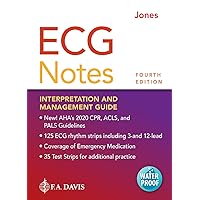 ECG Notes Interpretation and Management Guide ECG Notes Interpretation and Management Guide Spiral-bound Kindle