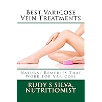 Best Varicose Vein Treatments: Natural Remedies That Work For Varicose Best Varicose Vein Treatments: Natural Remedies That Work For Varicose Paperback Kindle