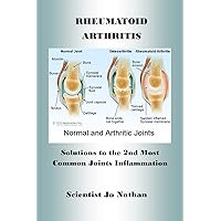 RHEUMATOID ARTHRITIS: Solutions to the Second Most Common Joints Inflammation Worldwide RHEUMATOID ARTHRITIS: Solutions to the Second Most Common Joints Inflammation Worldwide Kindle Paperback
