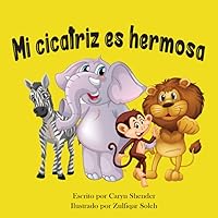 Mi cicatriz es hermosa (Spanish Edition) Mi cicatriz es hermosa (Spanish Edition) Paperback