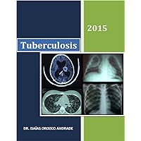 Tuberculosis 2015: Edición en español (Spanish Edition) Tuberculosis 2015: Edición en español (Spanish Edition) Kindle Paperback