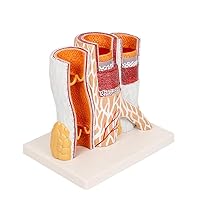 Teaching Model,Human Artery Anatomy Model, Vascular Section Model, Arterial Vein Vascular Model, Anatomical Vessel Atherosclerosis Thbus Vascular Model
