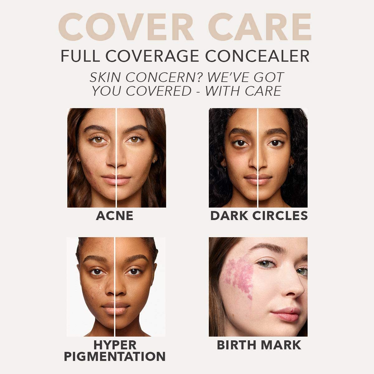 Dermablend Cover Care Concealer, Full Coverage Concealer Makeup and Corrector for Under Eye Dark Circles, Acne & Blemishes