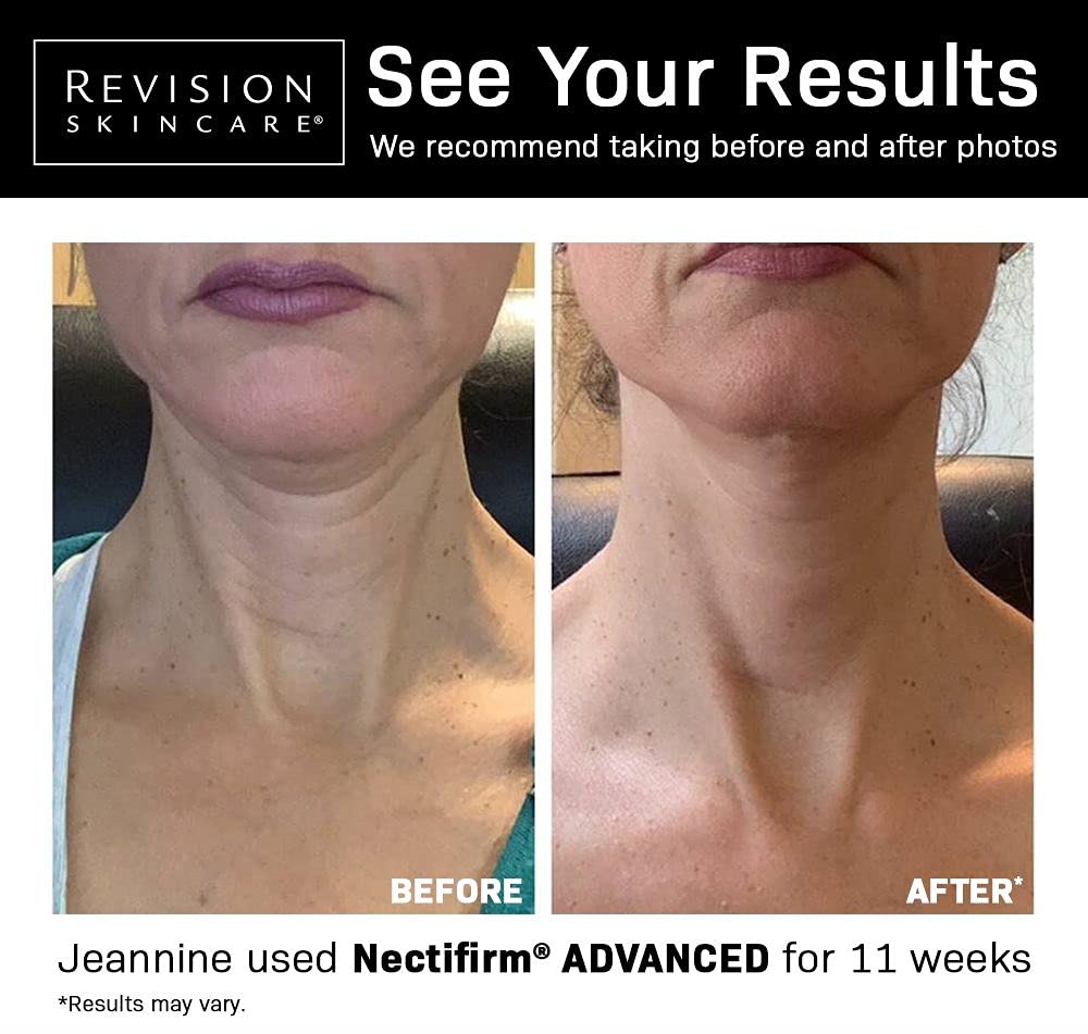 Revision Skincare Nectifirm Advanced Neck Firming Cream, 1.7 oz