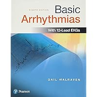 Basic Arrhythmias Basic Arrhythmias Paperback Kindle Spiral-bound