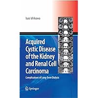 Acquired Cystic Disease of the Kidney and Renal Cell Carcinoma: Complication of Long-Term Dialysis Acquired Cystic Disease of the Kidney and Renal Cell Carcinoma: Complication of Long-Term Dialysis Kindle Hardcover Paperback