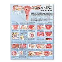 Common Gynecological Disorders Anatomical Chart
