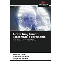 A rare lung tumor: Sarcomatoid carcinoma: Sarcomatoid carcinoma of the lung