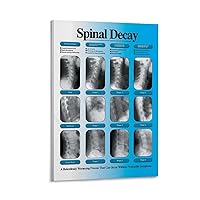 HWGACS Chiropractic Subluxation Degeneration Stage Poster Spine Hospital Decoration Poster (2) Home Living Room Bedroom Decoration Gift Printing Art Poster Frame-style 08x12inch(20x30cm)