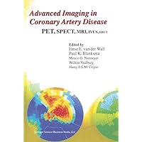 Advanced Imaging in Coronary Artery Disease: PET, SPECT, MRI, IVUS, EBCT (Developments in Cardiovascular Medicine Book 202) Advanced Imaging in Coronary Artery Disease: PET, SPECT, MRI, IVUS, EBCT (Developments in Cardiovascular Medicine Book 202) Kindle Hardcover Paperback
