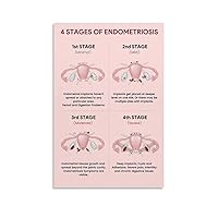 4 Stages of Endometriosis Poster Care for Women's Health Poster Hospital Gynecological Propagate Pos Canvas Painting Posters And Prints Wall Art Pictures for Living Room Bedroom Decor 12x18inch(30x45