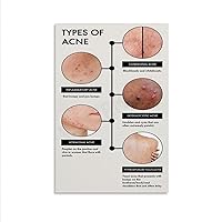 CSXCLYA Identify The Type of Acne And How to Treat Acne Skin Knowledge Poster (2) Wall Poster Art Canvas Printing Poster Office Bedroom Aesthetic Poster Unframe-style 20x30inch(50x75cm)