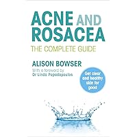 Acne and Rosacea: The Complete Guide Acne and Rosacea: The Complete Guide Kindle Paperback