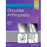Shoulder Arthroplasty Shoulder Arthroplasty Hardcover Kindle