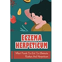 Eczema Herpeticum: What Foods To Eat To Eliminate Rashes And Herpeticum