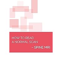 How to read a Normal Scan: Spine MRI (NEURORADIOLOGY: How to Read a Normal Scan Book 6) How to read a Normal Scan: Spine MRI (NEURORADIOLOGY: How to Read a Normal Scan Book 6) Kindle Paperback