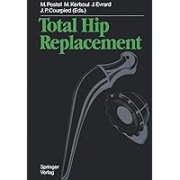 Total Hip Replacement Total Hip Replacement Paperback Hardcover