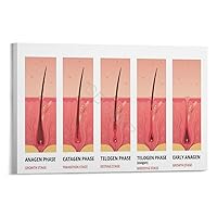 Hair Loss Poster Beauty Salon Treatment Poster Hair Follicle Growth Stages Chart Poster (4) Canvas Poster Bedroom Decor Office Room Decor Gift Frame-style 24x16inch(60x40cm)