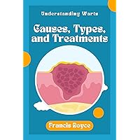 Understanding Warts: Causes, Types, and Treatments (Health, Diet and fitness Book 13) Understanding Warts: Causes, Types, and Treatments (Health, Diet and fitness Book 13) Kindle Paperback