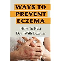 Ways To Prevent Eczema: How To Best Deal With Eczema