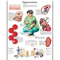 Hypertension Science Anatomy Posters for Walls Medical Nursing Students Educational Anatomical Poster Chart Medicine Disease Map for Doctor Medical Enthusiasts Kid's Enlightenment Education Waterproof Canvas