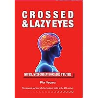 Crossed and lazy eyes: Myths, misconceptions and truths