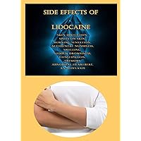 Side Effects of Lidocaine: Skin Irritation, Spots On Skin, Burning Sensation, Accidental Numbness, Swelling, Sudden Drowsiness, Constipation, Tremors, Abnormal Heartbeat, Anaphylaxis