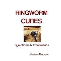 Ringworm Cures: Symptoms & Treatments