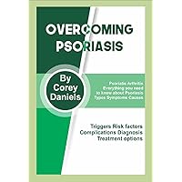OVERCOMING PSORIASIS: Psoriatic Arthritis, Everything you need to know about Psoriasis, Types Symptoms Causes Triggers Risk factors Complications Diagnosis Treatment options OVERCOMING PSORIASIS: Psoriatic Arthritis, Everything you need to know about Psoriasis, Types Symptoms Causes Triggers Risk factors Complications Diagnosis Treatment options Kindle Paperback