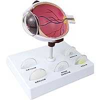 Cornea Eyeball Model Human Eye Model Human Eye Demonstration Teaching Prop Cataract Anatomy Teaching Model