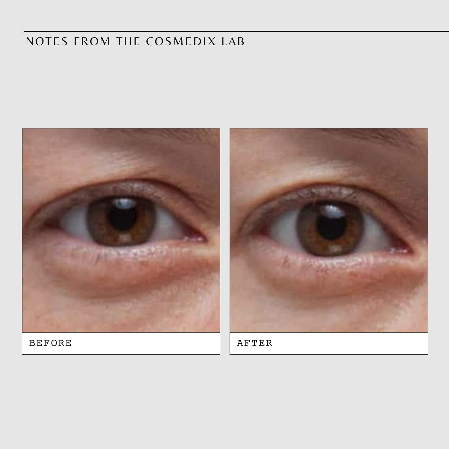 COSMEDIX Opti Crystal Liquid Eye Serum - Under Eye Brightener & Hydrator - Reduces Under Eye Bags, Wrinkles, Fine Lines, Dark Circles, Puffiness & Crows Feet - Serum for Skin Care