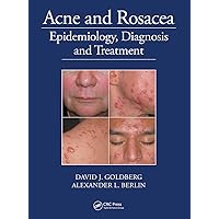Acne and Rosacea Acne and Rosacea Paperback Kindle Hardcover