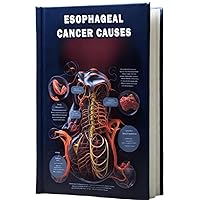 Esophageal Cancer Causes: Understand the causes and risk factors associated with esophageal cancer, a malignancy that affects the esophagus. Esophageal Cancer Causes: Understand the causes and risk factors associated with esophageal cancer, a malignancy that affects the esophagus. Paperback
