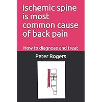Ischemic spine is most common cause of back pain: How to diagnose and treat Ischemic spine is most common cause of back pain: How to diagnose and treat Paperback Audible Audiobook