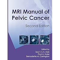 MRI Manual of Pelvic Cancer,Second Edition MRI Manual of Pelvic Cancer,Second Edition Hardcover