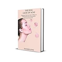 The Real Cause Of Acne: Understand what your skin is telling you. Eliminate the root of the problem and set your beauty free! The Real Cause Of Acne: Understand what your skin is telling you. Eliminate the root of the problem and set your beauty free! Kindle Paperback