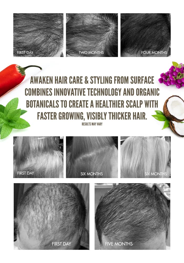 Surface Hair Awaken Kit: Shampoo, Conditioner, Scalp Elixir and Therapeutic Treatment - for Thinning Hair, Hair Loss and Thickening
