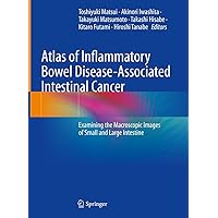 Atlas of Inflammatory Bowel Disease-Associated Intestinal Cancer: Examining the Macroscopic Images of Small and Large Intestine Atlas of Inflammatory Bowel Disease-Associated Intestinal Cancer: Examining the Macroscopic Images of Small and Large Intestine Kindle Hardcover Paperback