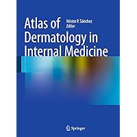 Atlas of Dermatology in Internal Medicine Atlas of Dermatology in Internal Medicine Kindle Paperback