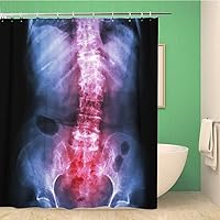 Bathroom Shower Curtain Spondylosis and Scoliosis Film X Ray Lumbar Sacrum Spine Polyester Fabric 60x72 inches Waterproof Bath Curtain Set with Hooks