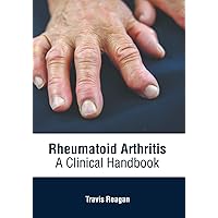 Rheumatoid Arthritis: A Clinical Handbook Rheumatoid Arthritis: A Clinical Handbook Hardcover
