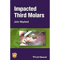 Impacted Third Molars Impacted Third Molars Hardcover